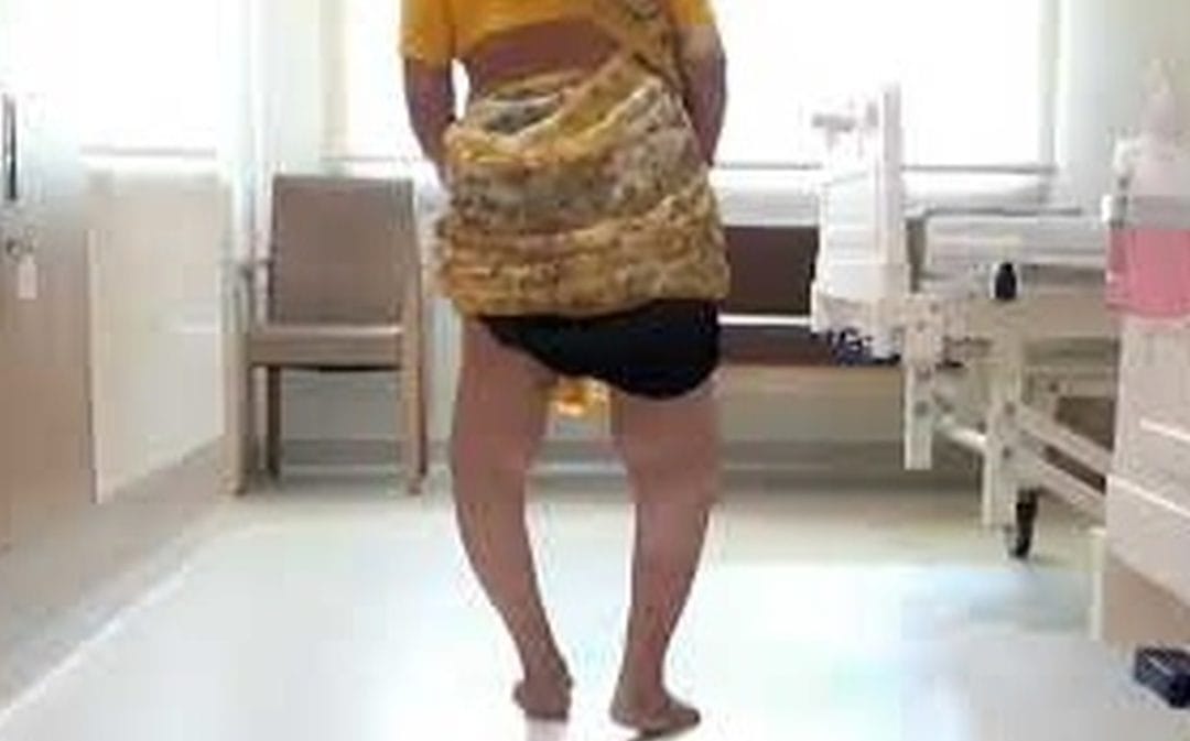 Bilateral Total Knee Replacement