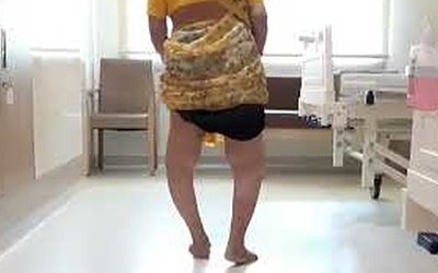 Bilateral Total Knee Replacement